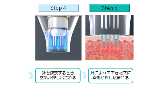 ボリュームアップ流れ
