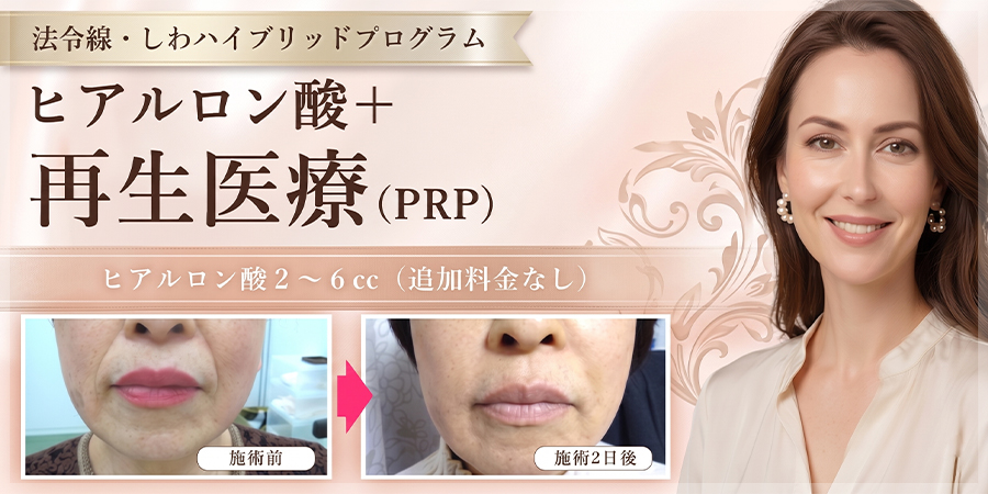 法令線・しわハイブリッド治療